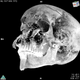 Imagen 3D del cráneo herido del faraón.
